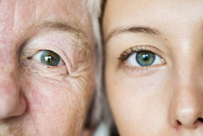 На скорость старения также сильно влияет генетика. Фото.