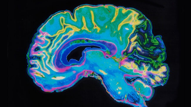 Мозг – самый сложный и малоизученный орган человеческого тела,. Фото.