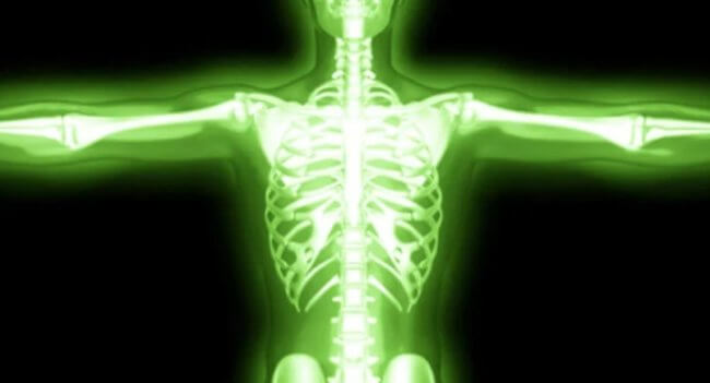 Последствия обесточивания атомной электростанции. О том, что радиация делает с организмом человека, можете почитать тут. Фото.