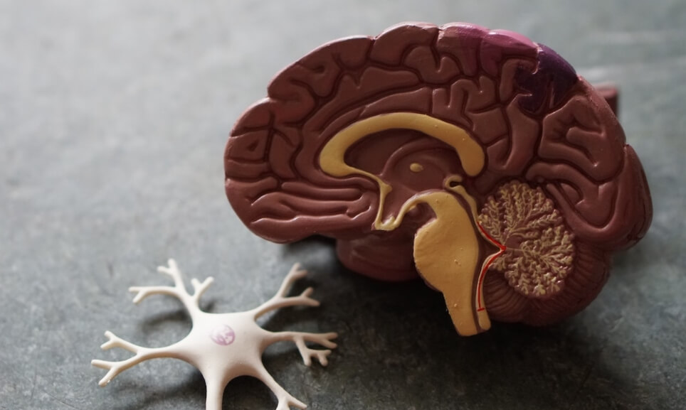 Иногда афазия является следствием нейродегенеративных болезней. Фото.