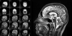 Может ли сканирование мозга объяснить поведение человека? Фото.