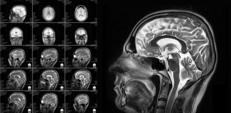 Может ли сканирование мозга объяснить поведение человека? томография мозга показывает о человеческом поведении, вероятно, основаны на исследованиях, результаты которых не будут подтверждены дальнейшими исследованиями. Фото.