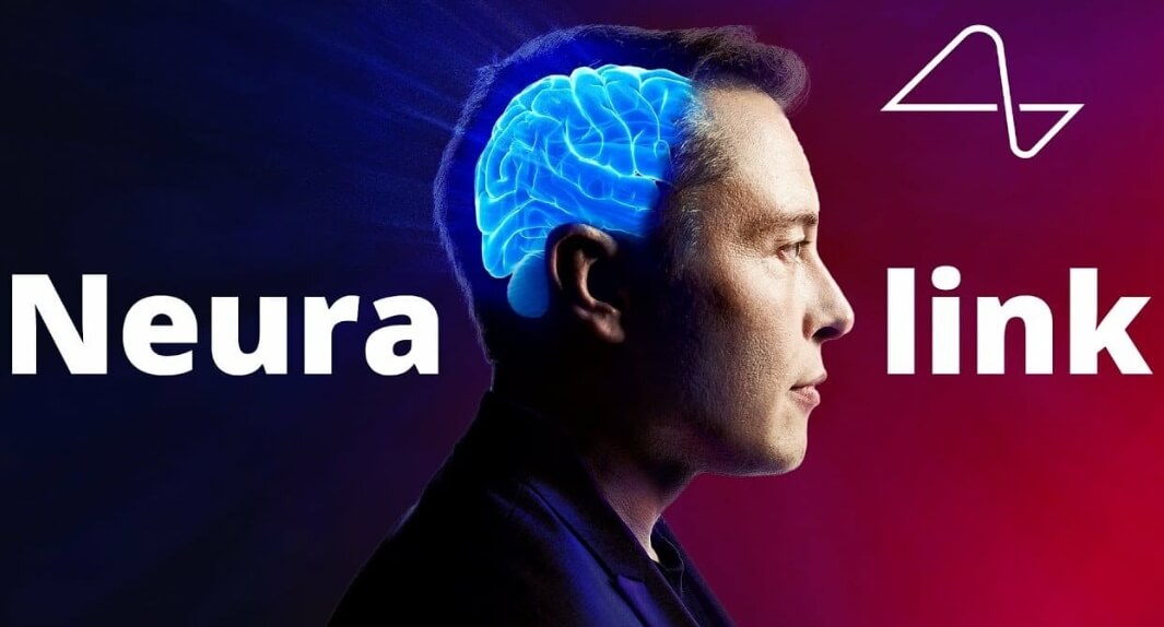 Илон Маск хочет имплантировать чипы в головы людей, но не слишком ли это смело? Фото.