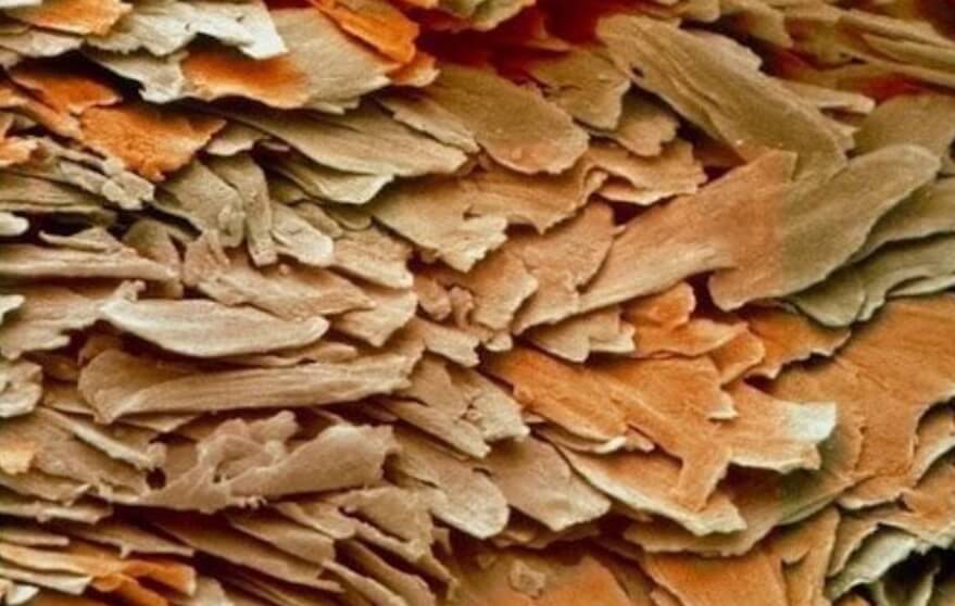 Ноготь человека под микроскопом является далеко не самым приятным зрелищем. Фото.