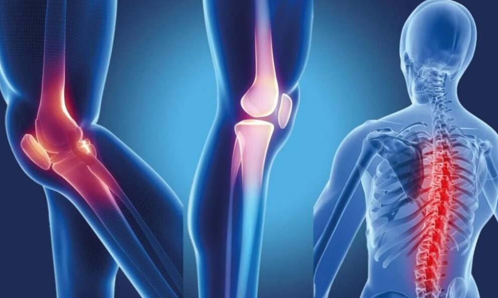 Вегетарианство может ухудшить состояние костей и суставов. Фото.