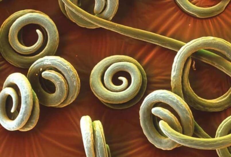 Чем опасны глисты? Всех гельминтов объединяет одно — они мерзкие. Фото.