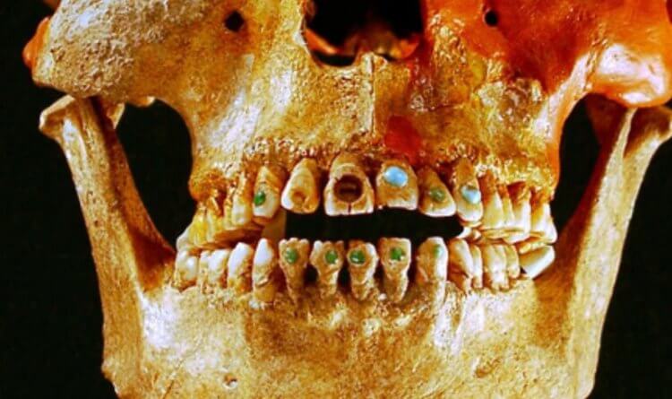 Украшение и лечение зубов у майя. Череп представителя майя с украшенными камнями зубами. Фото.