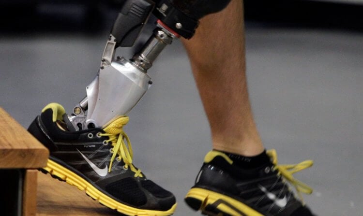 Сколько стоят протезы рук и ног? Бионический протез ноги. Фото.