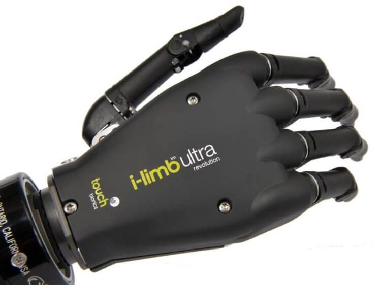 Самые популярные протезы рук и ног. Бионическая рука i-limb. Фото.