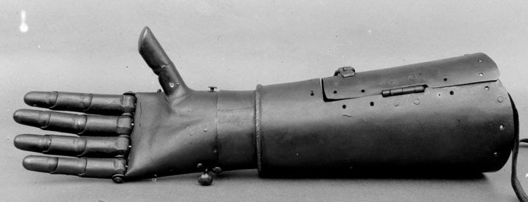 Как появились протезы рук и ног? Одна из первых бионических рук в истории. Фото.