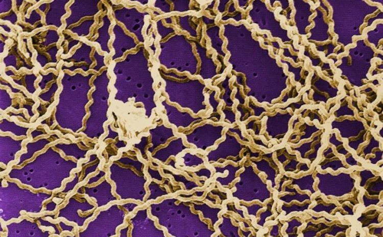 Лептоспироз. Бактерии Leptospira под микроскопом. Фото.