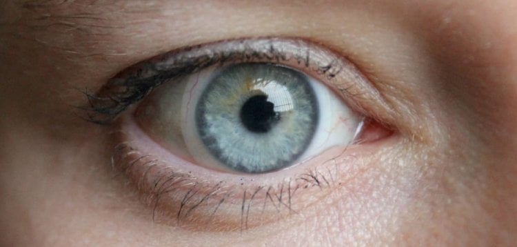 К каким ужасным последствиям может привести ношение линз? В некоторых случаях контактные линзы могут сильно навредить глазам. Фото.