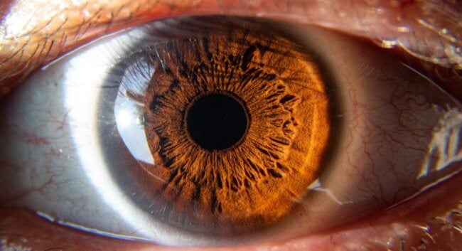 Ученые восстановили работу глаз умершего человека. Фото.