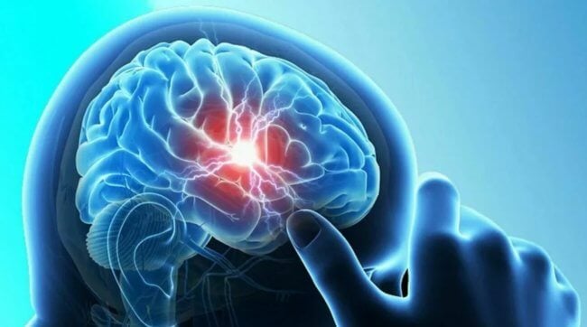 Что такое сотрясение мозга и чем оно опасно? Фото.