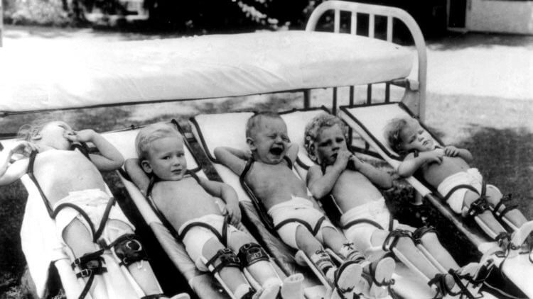 Что такое полиомиелит. В середине прошлого века полиомиелит унес множество жизней в США, Европе, СССР, Азии и Африке. Фото.