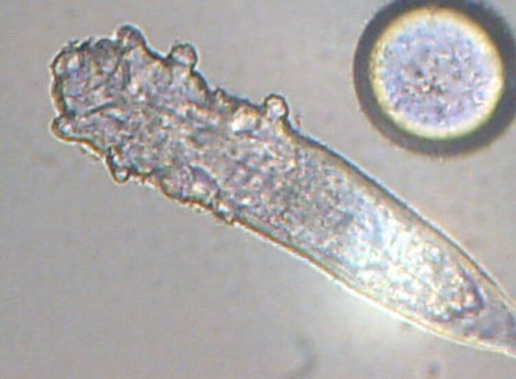 Клещей нельзя увидеть без микроскопа. Угревой клещ под микроскопом. Фото.
