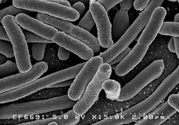 Кишечная палочка — возбудитель инфекций. Кишечная палочка Escherichia coli. Фото.
