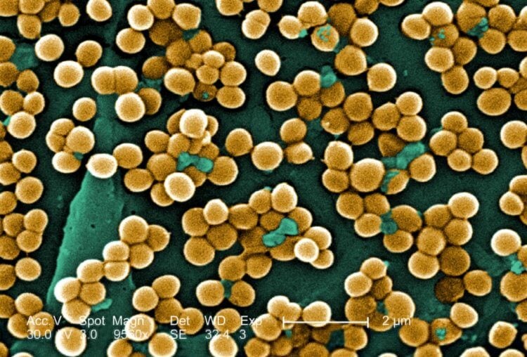 Стафилококки — причина воспалений. Золотистый стафилококк (Staphylococcus aureus). Фото.