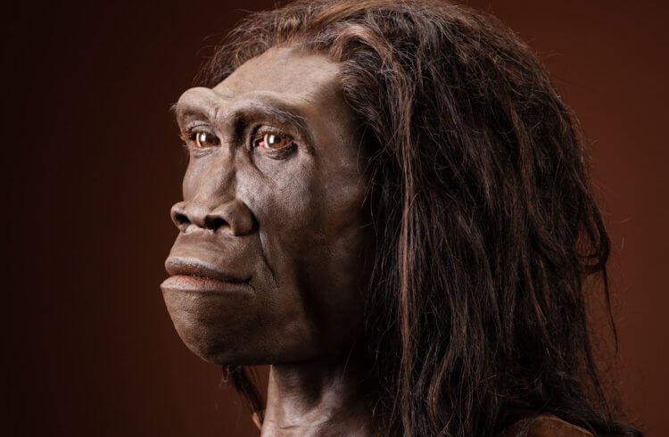 Болезнь человека прямоходящего. Представитель вида Homo erectus. Фото.