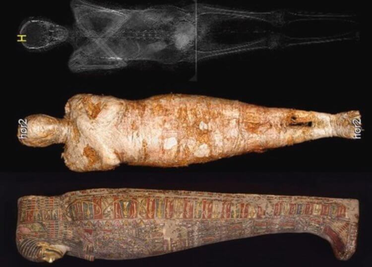 Египетская мумия со следами опасного заболевания. Египетская мумия, которая уже более века хранится в Варшавском музее. Фото.