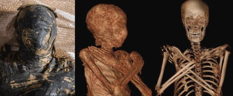 Египетская мумия со следами опасного заболевания. Внутренности египетской мумии. Фото.