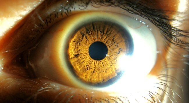5 болезней, которые можно определить по состоянию глаз. Фото.