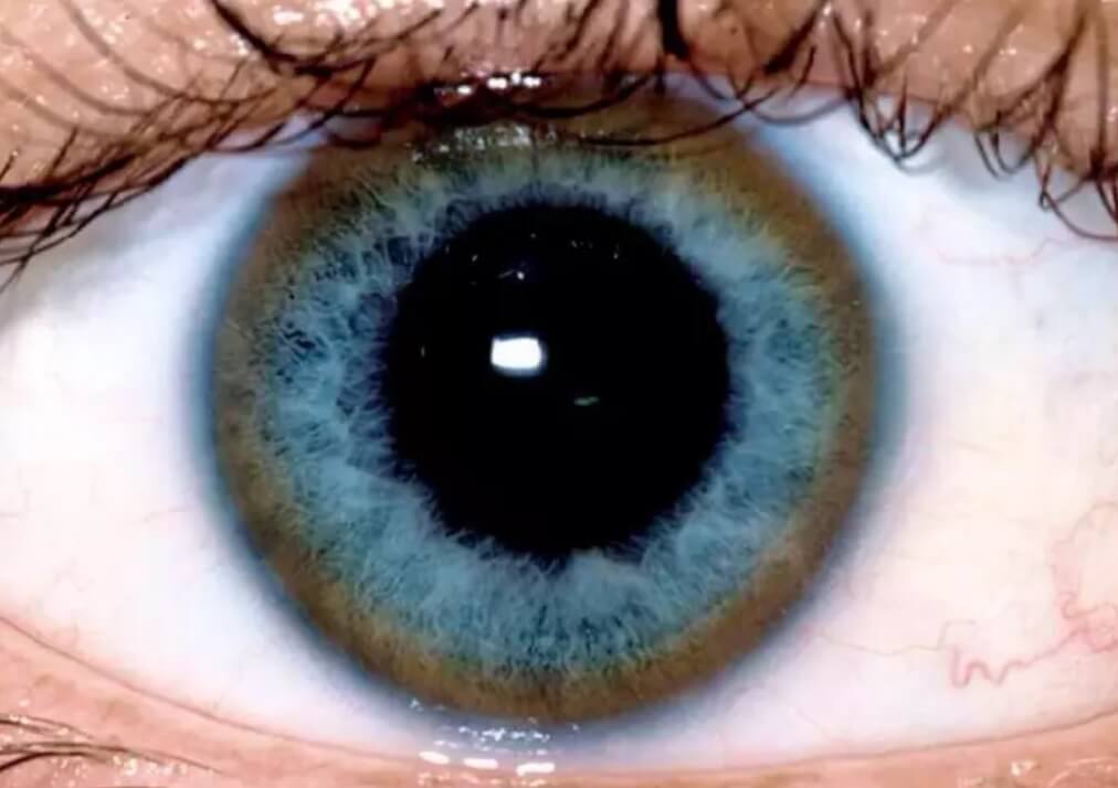 5 болезней, которые можно определить по состоянию глаз