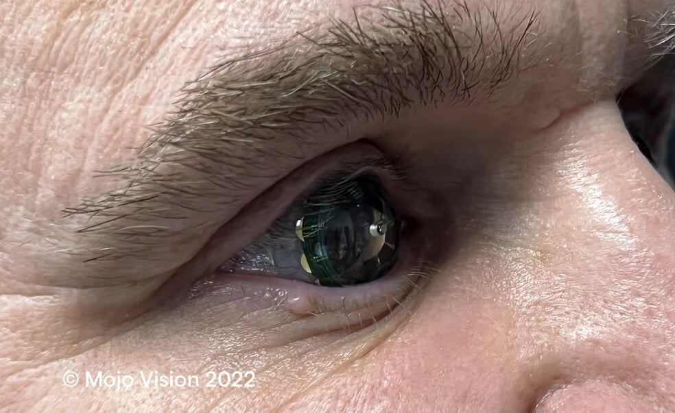 mojo lenses 1 2 <p>На протяжении многих лет люди с проблемами со зрением были вынуждены носить очки, которые неудобны тем, что постоянно пачкаются и потеют. К счастью, в 1971 году американская компания Bausch+Lomb получила разрешение на продажу мягких контактных линз и спустя несколько десятилетий они обрели массовую популярность. На данный момент большинство производителей линз пытаются сделать их более комфортными для глаз и долговечными. Однако, существуют компании, которые хотят наделить контактные линзы дополнительными функциями. Например, стартап Mojo Vision уже несколько лет разрабатывает контактные линзы с функцией дополненной реальности. Можно подумать, это очередной проект, который скоро провалится, но нет - недавно разработанные очки начали носить добровольцы. На основе их отзывов будет создана финальная версия, которая вполне может появиться в продаже. Цена нового поколения контактных линз будет как у дорогого смартфона.