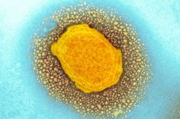 Как проявляется оспа обезьян. Вирус оспы обезьян под микроскопом. Фото.