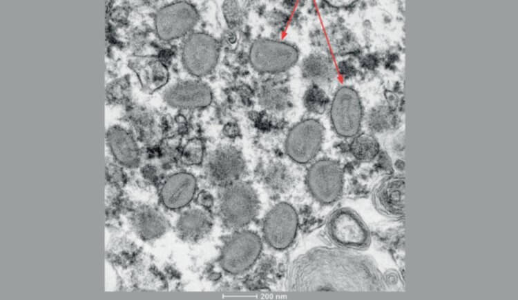 Новые симптомы оспы обезьян. Две вирусные частицы оспы обезьян, снятые при помощи электронного микроскопа. Фото.