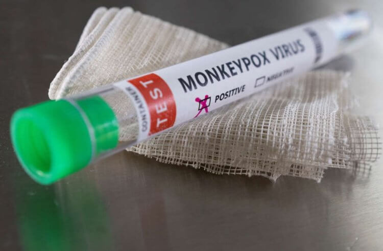 Пути передачи оспы обезьян. Вакцин, которые могут защитить от оспы обезьян, практически не существует. Фото.