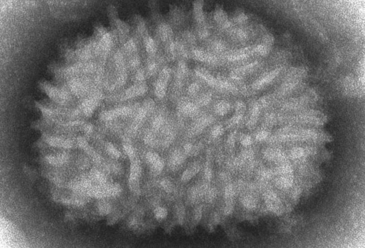 Как защититься от оспы обезьян? Вирус оспы под микроскопом. Фото.