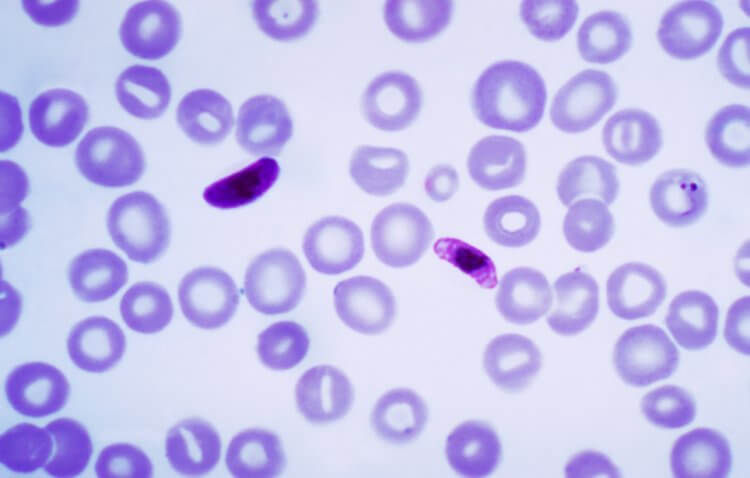 Малярия — главная болезнь комаров. Возбудители малярии Plasmodium. Фото.