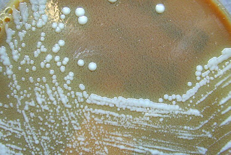 Туляремия — инфекция от комаров. Колония бактерий Francisella tularensis. Фото.