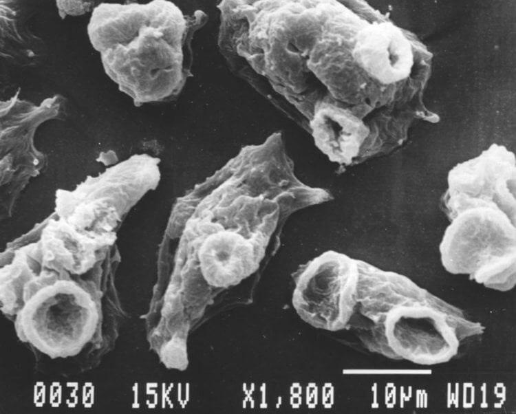 Микробы, которые поедают мозг. Naegleria fowleri под микроскопом. Фото.