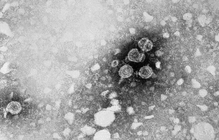 Вакцина против гепатита В. Вирионы вируса гепатита B. Фото.