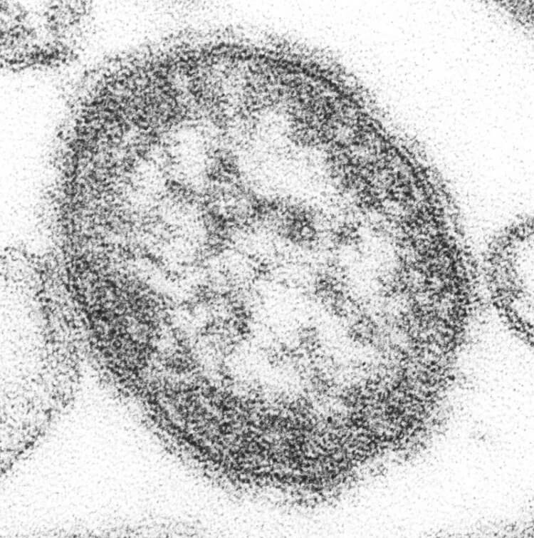 MMR — вакцина против кори, свинки и краснухи. Вирус кори Measles morbillivirus. Фото.