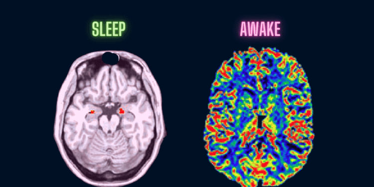 Миф о четырех часах сна. Во сне мозг выглядит и ведет себя по-разному. Фото.