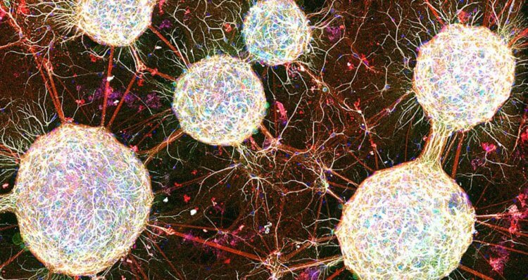 Как в лабораторных условиях вырастили “искусственный мозг”. Из стволовых клеток ученым удалось создать модульные нейронные сети. Фото.