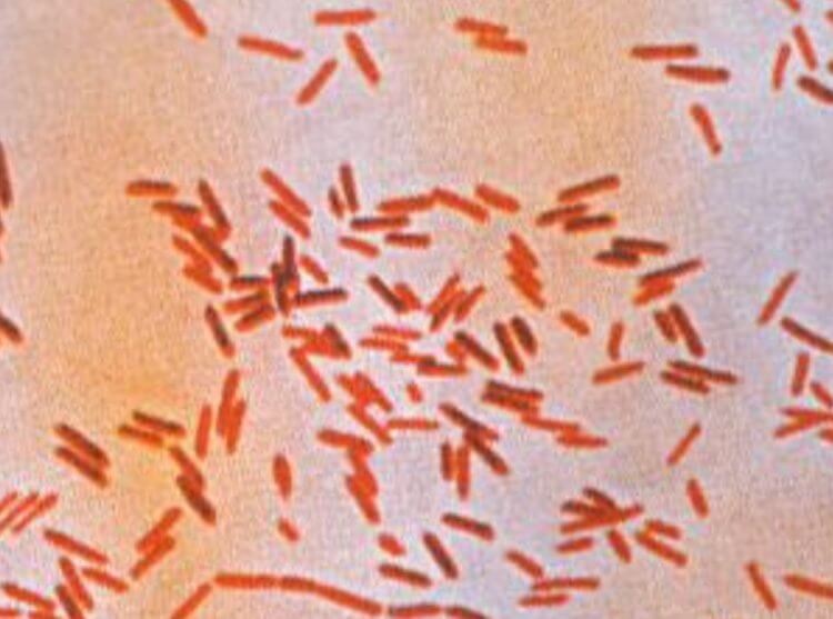 Какие болезни распространяют тараканы. Возбудители сальмонеллеза под микроскопом. Фото.
