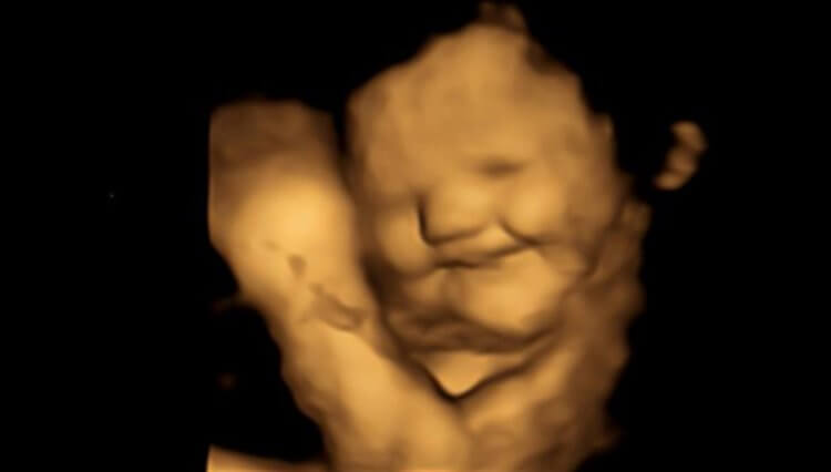 Фото ребенка в утробе