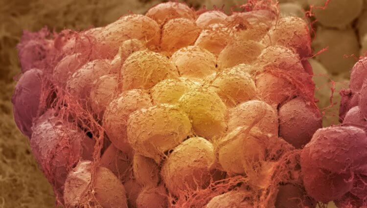 Ученые выяснили как и зачем жир в организме “общается” с мозгом. В жировой ткани ученые обнаружили сенсорные нейроны, который посылают импульсы в мозг. Фото.
