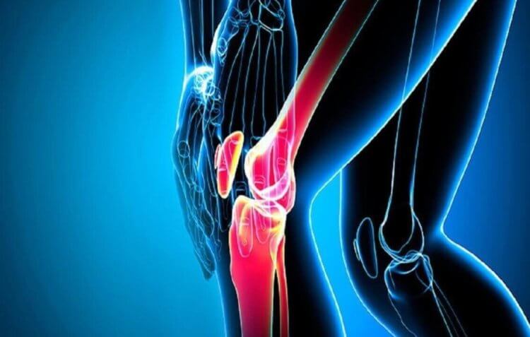 Боли в суставах. Боли в коленях тоже сигнализируют о том, что в организме что-то не так. Фото.