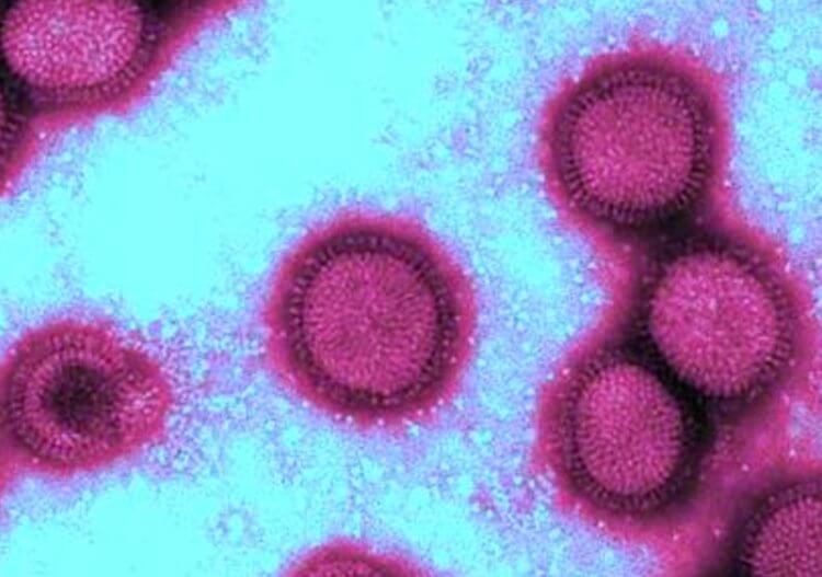 Осенью возбудители болезней живут дольше. Вирус гриппа Influenza A virus H1N1. Фото.