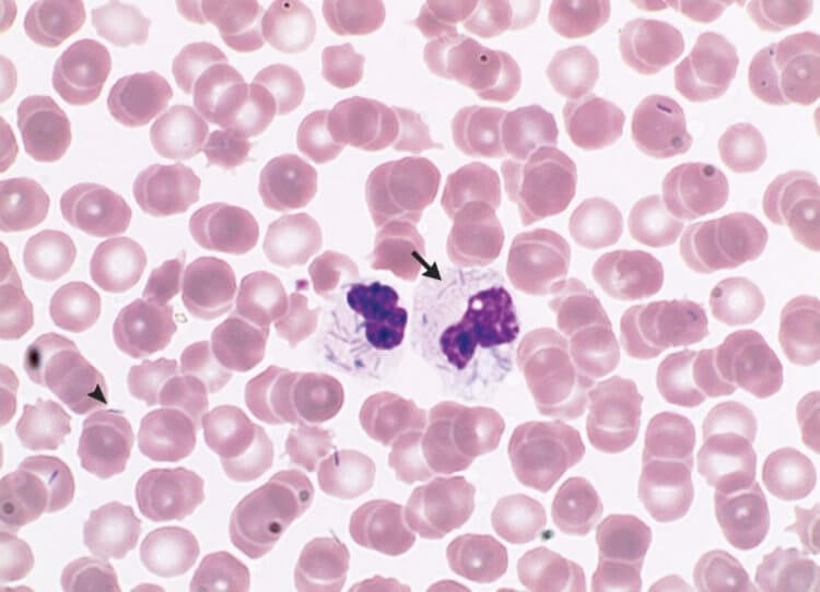Заражение крови после собак. Бактерия Capnocytophaga canimorsus. Фото.