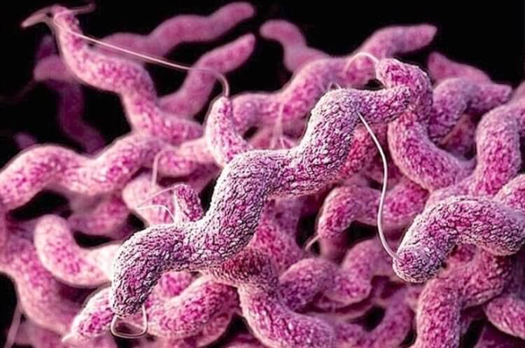 Какие инфекции передаются собаками. Бактерии Campylobacter jejuni. Фото.
