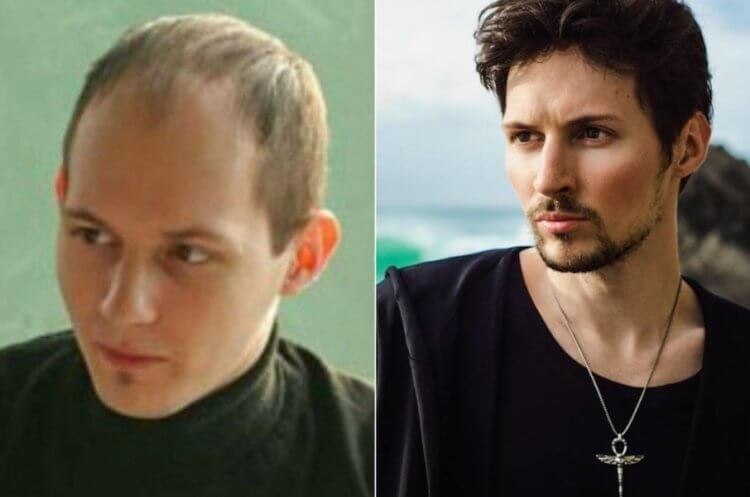 Как пересаживают волосы и сколько стоит такая операция. Павел Дуров до и после пересадки волос. Фото.