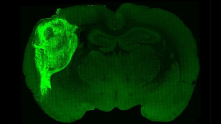Пересадка мозга крысе. Органоид человека в мозге крысы. Фото.