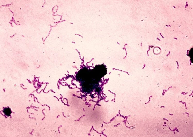 Опасность бактерий во рту. Бактерии Streptococcus mutans. Фото.