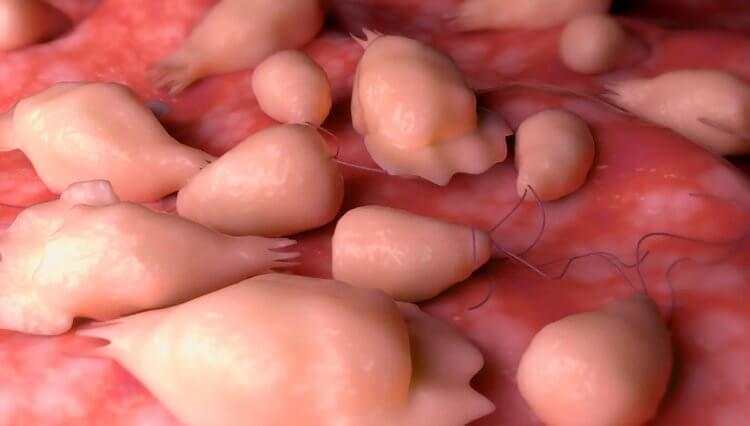 Паразит Неглерия Фоулера. 3D-изображение паразитов Naegleria fowleri в тканях головного мозга. Фото.